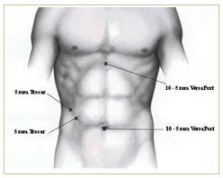 Slider image (3) Panama Gastric Surgery Center